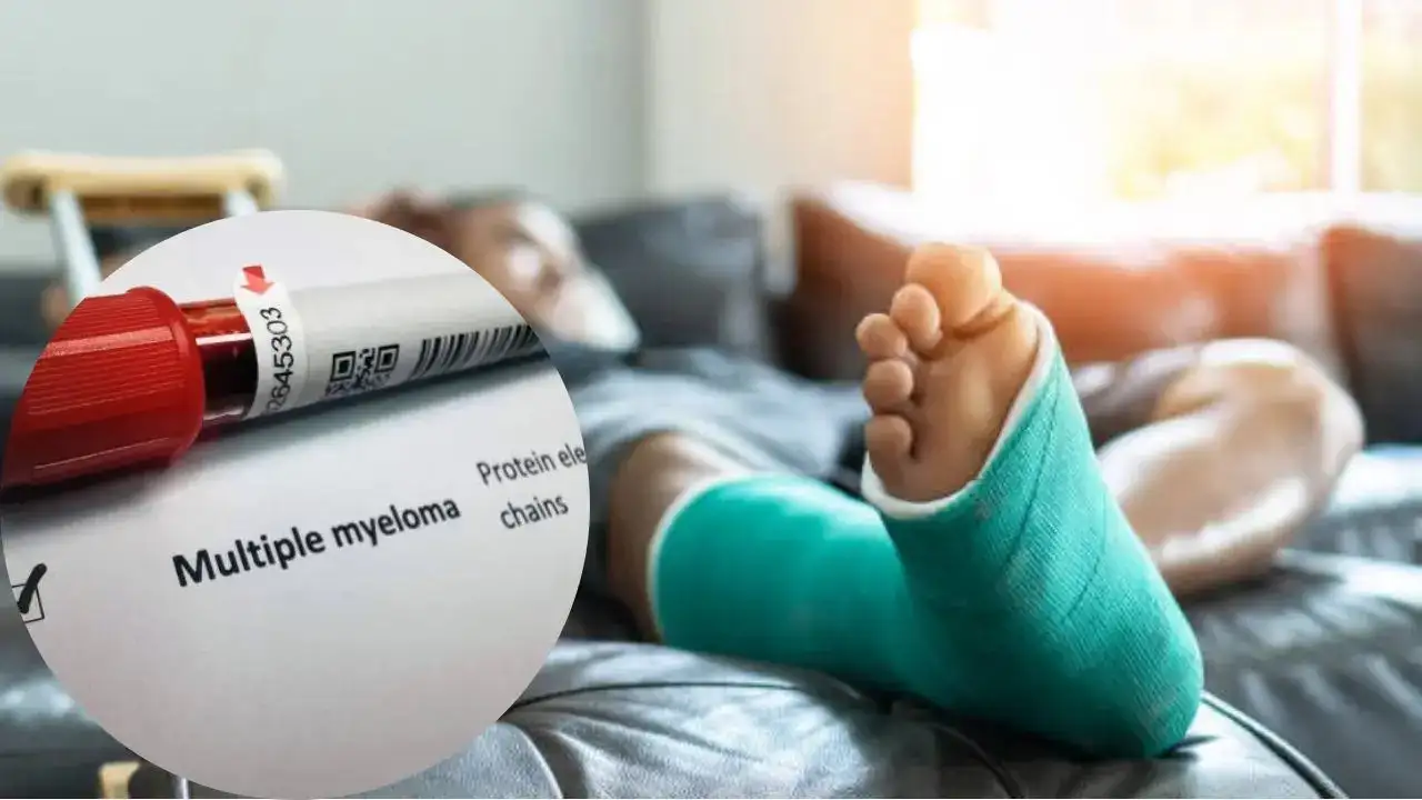 Frequent Fractures Without Injury - It Could Be a Sign of Cancer!